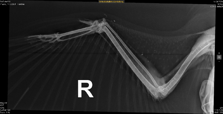 Roentgen_R